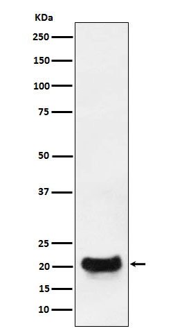 1 - Anti-DCTN5 Rabbit Monoclonal Antibody ABO15992