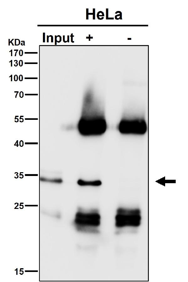 1 - Anti-Gemin 2 Rabbit Monoclonal Antibody ABO15993