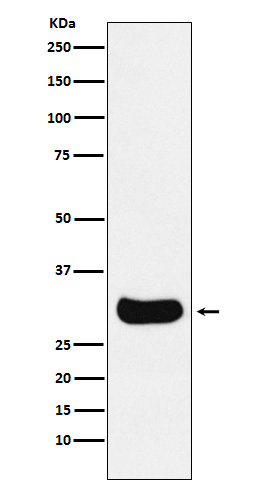 1 - Anti-Gemin 2 Rabbit Monoclonal Antibody ABO15993
