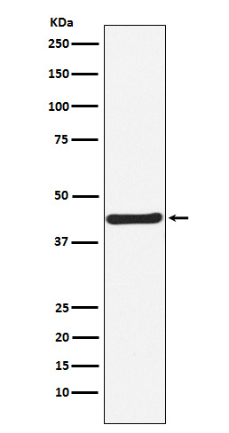 1 - Anti-HOXA5 Rabbit Monoclonal Antibody ABO15994