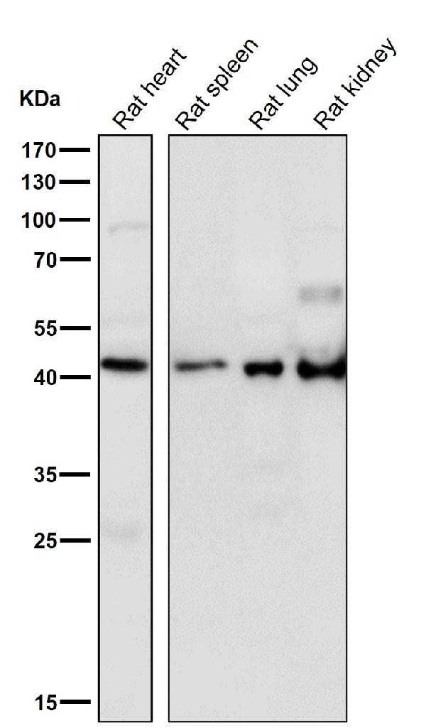 1 - Anti-HOXA5 Rabbit Monoclonal Antibody ABO15994