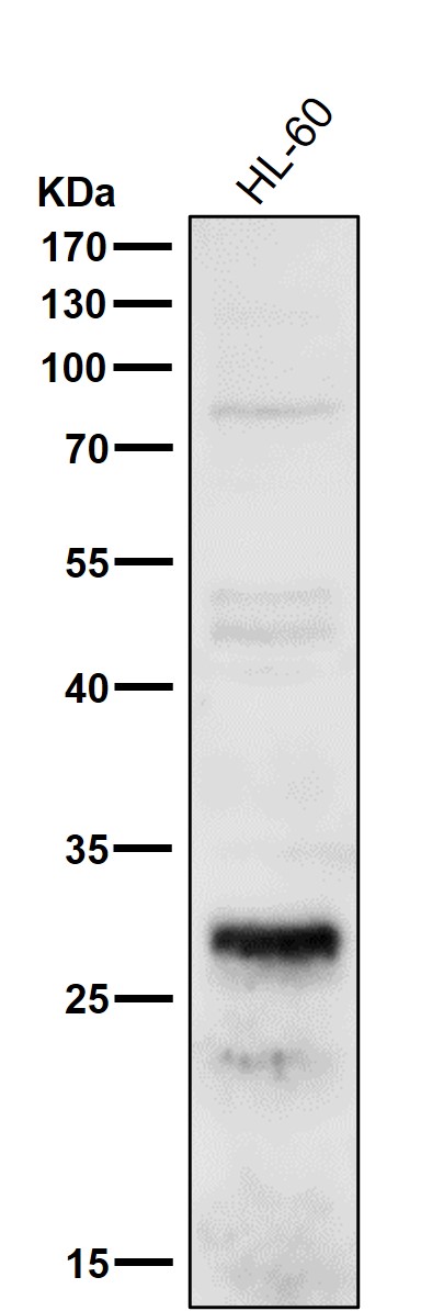 1 - Anti-HOXA5 Rabbit Monoclonal Antibody ABO15994