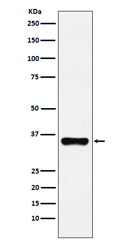 1 - Anti-HOXA9 Rabbit Monoclonal Antibody ABO15995