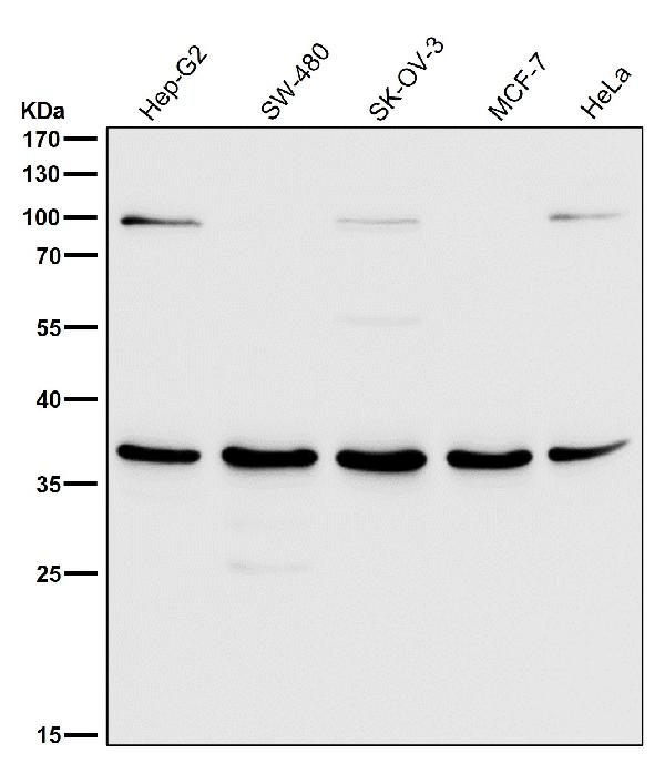 1 - Anti-HOXA9 Rabbit Monoclonal Antibody ABO15995