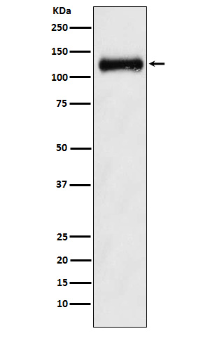 1 - Anti-ANPRB Rabbit Monoclonal Antibody ABO15998