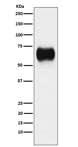 1 - Anti-MICA Rabbit Monoclonal Antibody ABO15999