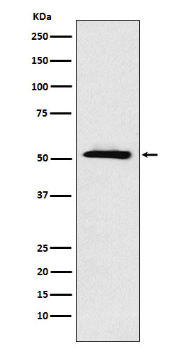 1 - Anti-ETV6 Rabbit Monoclonal Antibody ABO16000