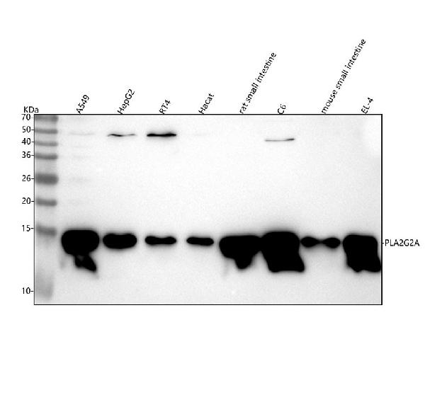 1 - Anti-PLA2G2A Rabbit Monoclonal Antibody ABO16001