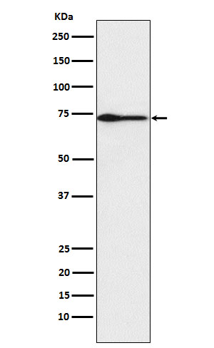 1 - Anti-PROS1 Rabbit Monoclonal Antibody ABO16003