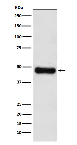 1 - Anti-ADK Rabbit Monoclonal Antibody ABO16004