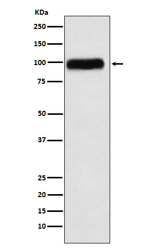 1 - Anti-SERPING1 Rabbit Monoclonal Antibody ABO16007