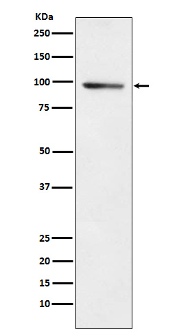 1 - Anti-PDE4B Rabbit Monoclonal Antibody ABO16015