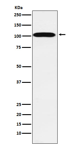 1 - Anti-ATP1A2 Rabbit Monoclonal Antibody ABO16016