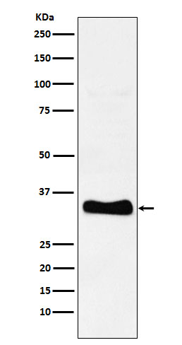 1 - Anti-Monoacylglycerol Lipase Rabbit Monoclonal Antibody ABO16021