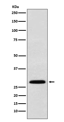1 - Anti-KGF Rabbit Monoclonal Antibody ABO16025