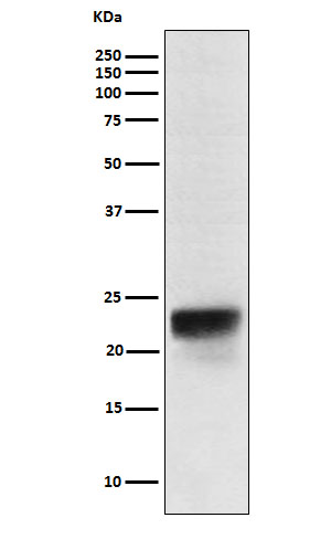 1 - Anti-FSH beta Rabbit Monoclonal Antibody ABO16026
