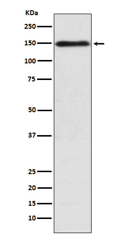 1 - Anti-COL11A1 Rabbit Monoclonal Antibody ABO16029
