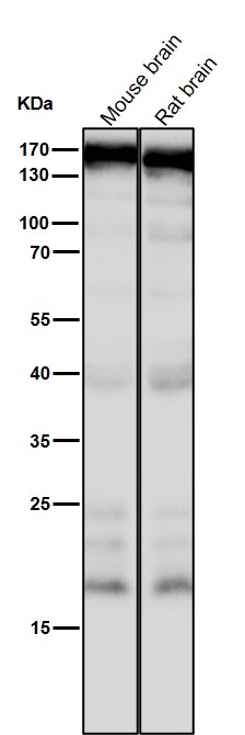 1 - Anti-CNTP2 Rabbit Monoclonal Antibody ABO16031