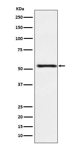 1 - Anti-ATP4B Rabbit Monoclonal Antibody ABO16032