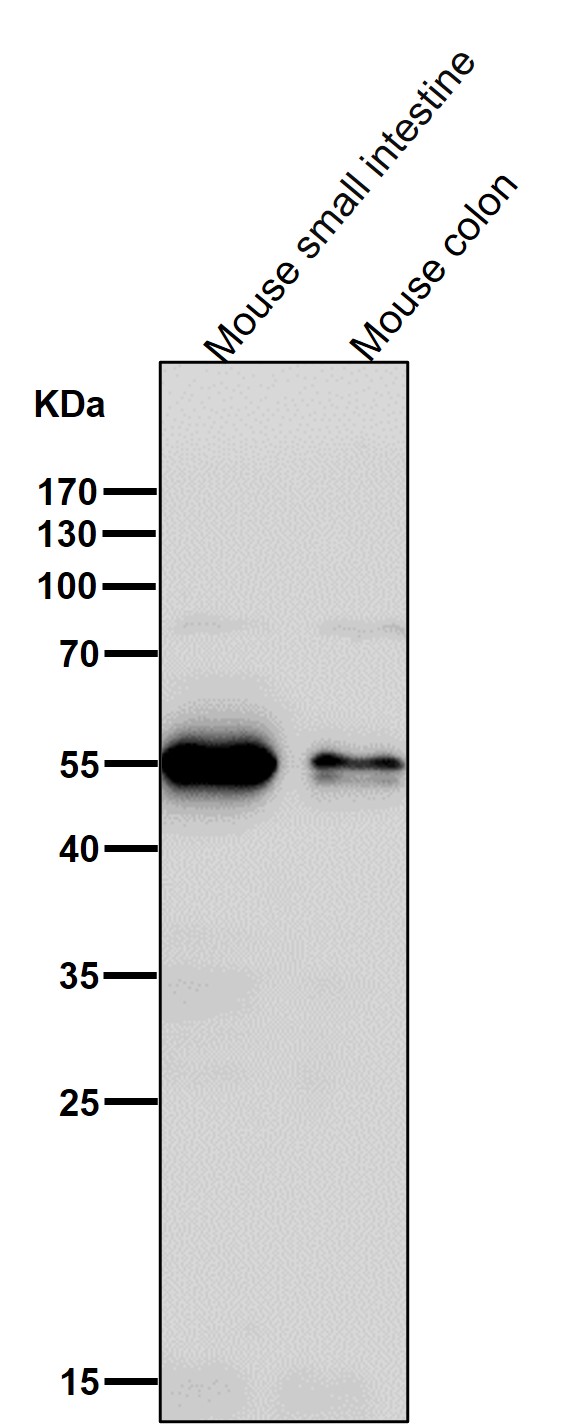 1 - Anti-ATP4B Rabbit Monoclonal Antibody ABO16032