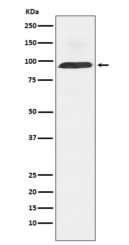 1 - Anti-Dynamin 3 Rabbit Monoclonal Antibody ABO16035