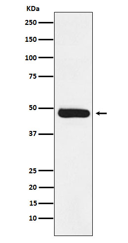 1 - Anti-ERCC8 Rabbit Monoclonal Antibody ABO16036