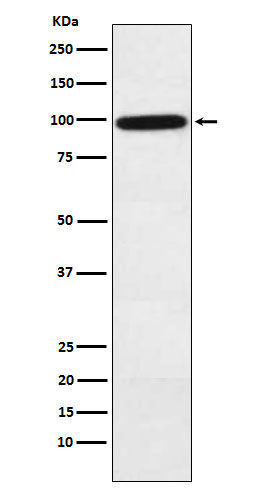 1 - Anti-Complement factor B Rabbit Monoclonal Antibody ABO16037