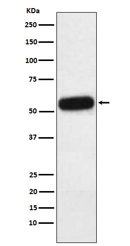 1 - Anti-Fetuin A Rabbit Monoclonal Antibody ABO16038
