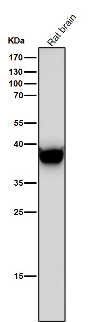 1 - Anti-LHX2 Rabbit Monoclonal Antibody ABO16039