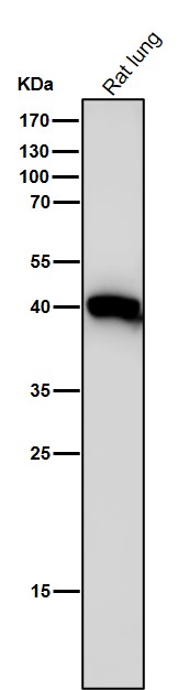 1 - Anti-LHX2 Rabbit Monoclonal Antibody ABO16039