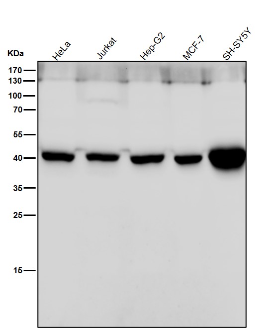 1 - Anti-LHX2 Rabbit Monoclonal Antibody ABO16039