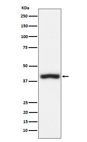 1 - Anti-CD1c Rabbit Monoclonal Antibody ABO16040