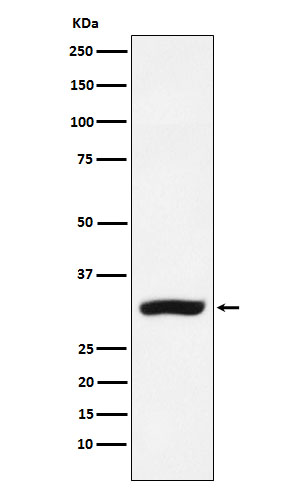 1 - Anti-CBR1 Rabbit Monoclonal Antibody ABO16041