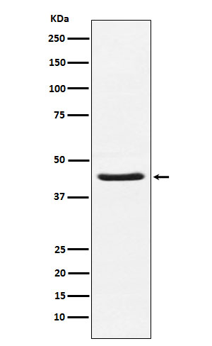 1 - Anti-HSD3B1 Rabbit Monoclonal Antibody ABO16042