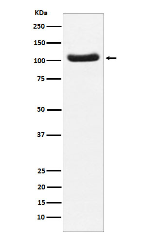 1 - Anti-PDE2A Rabbit Monoclonal Antibody ABO16043