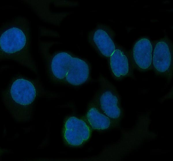 3 - Anti-NUP62 Rabbit Monoclonal Antibody ABO16047