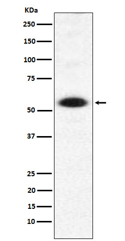 1 - Anti-DMAP1 Rabbit Monoclonal Antibody ABO16048