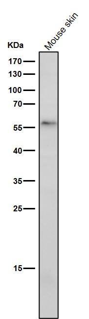 1 - Anti-DMAP1 Rabbit Monoclonal Antibody ABO16048