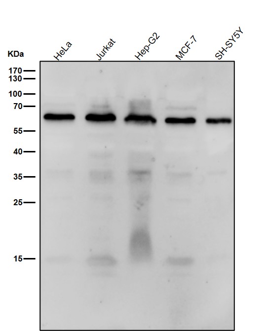 1 - Anti-DMAP1 Rabbit Monoclonal Antibody ABO16048