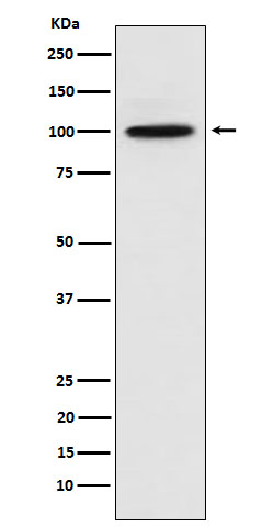 1 - Anti-CTNNA3 Rabbit Monoclonal Antibody ABO16049