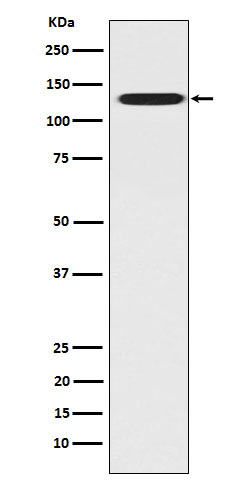 1 - Anti-CC2D1A Rabbit Monoclonal Antibody ABO16051