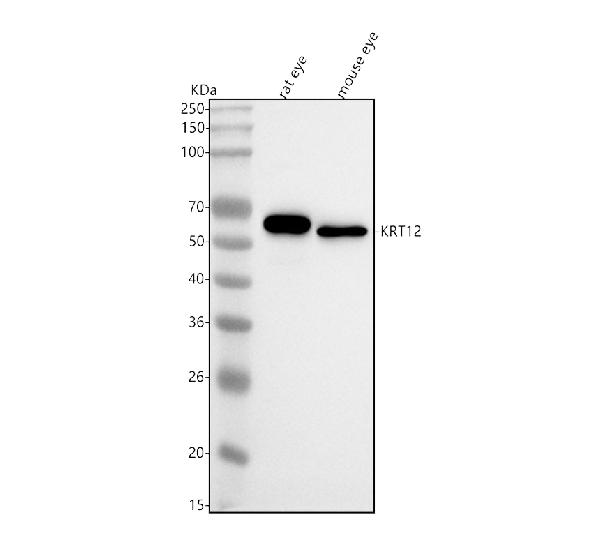 1 - Anti-Cytokeratin 12 Rabbit Monoclonal Antibody ABO16052