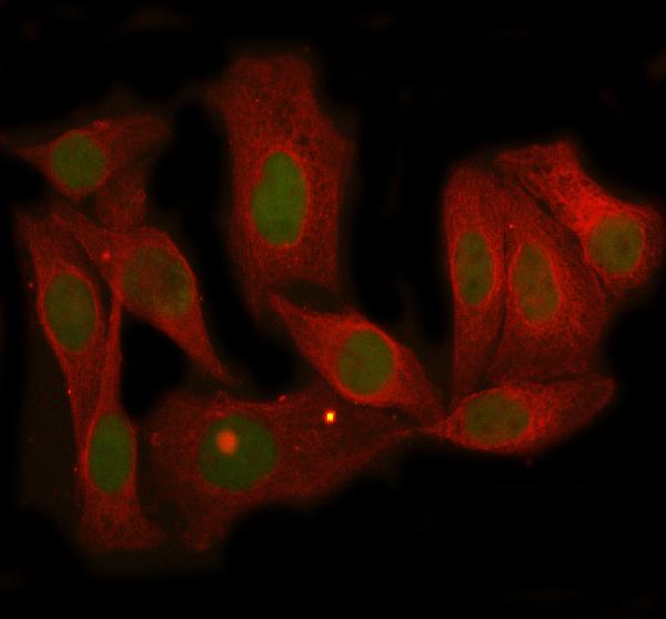 3 - Anti-MBD3 Rabbit Monoclonal Antibody ABO16053