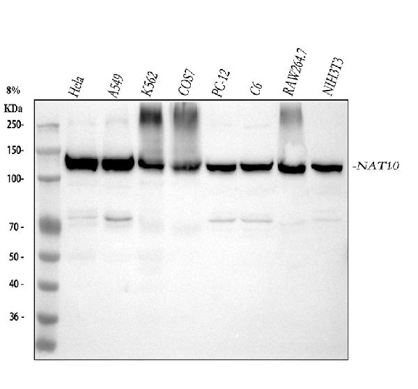 1 - Anti-NAT10 Rabbit Monoclonal Antibody ABO16055