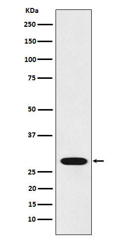 1 - Anti-RCHY1 Rabbit Monoclonal Antibody ABO16056