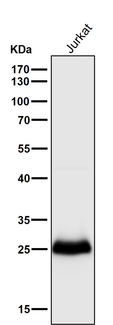 1 - Anti-RCHY1 Rabbit Monoclonal Antibody ABO16056