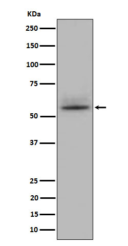 1 - Anti-CD147 Rabbit Monoclonal Antibody ABO16062