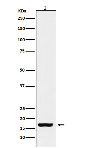 1 - Anti-Histone H3 (acetyl K18) Rabbit Monoclonal Antibody ABO16065