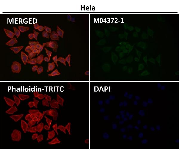1 - Anti-FACL4 Rabbit Monoclonal Antibody ABO16069
