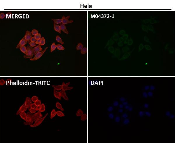 1 - Anti-FACL4 Rabbit Monoclonal Antibody ABO16069